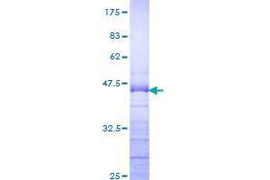Image no. 1 for DEAD (Asp-Glu-Ala-Asp) Box Polypeptide 54 (DDX54) (AA 778-881) protein (GST tag) (ABIN1351370)