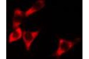 ABIN6274275 staining HeLa cells by IF/ICC. (BCAP31 anticorps  (C-Term))