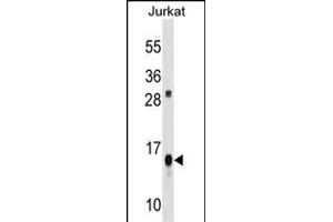 ATP5D Antibody (C-term) (ABIN1536694 and ABIN2848523) western blot analysis in Jurkat cell line lysates (35 μg/lane). (ATP5F1D anticorps  (C-Term))