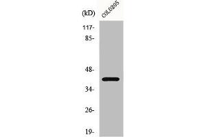 Western Blot analysis of COLO205 cells using GPR62 Polyclonal Antibody (GPR62 anticorps  (Internal Region))