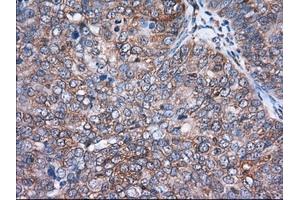 Immunohistochemical staining of paraffin-embedded Human Kidney tissue using anti-ACAT2 mouse monoclonal antibody. (ACAT2 anticorps)