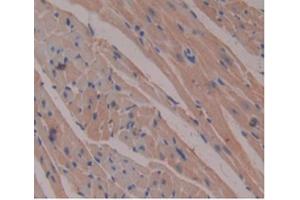 Detection of b2M in Mouse Heart Tissue using Monoclonal Antibody to Beta-2-Microglobulin (b2M)