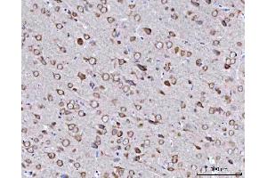 IHC analysis of BBS9 using anti-BBS9 antibody (ABIN7601518). (BBS9 anticorps  (AA 37-793))