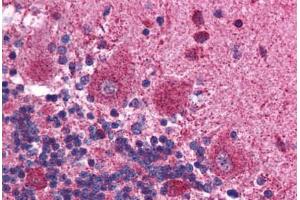 Human Brain, Cerebellum (formalin-fixed, paraffin-embedded) stained with MAPK14 antibody ABIN214794 at 2.