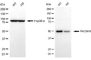 Western blotting analysis using PACSIN3 antibody (ABIN7799982).