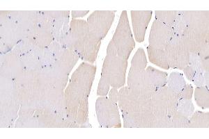 Detection of LSR in Human Skeletal muscle Tissue using Polyclonal Antibody to Lipolysis Stimulated Lipoprotein Receptor (LSR)