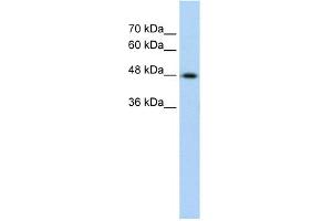 WB Suggested Anti-KRT17 Antibody Titration:  0. (KRT17 anticorps  (C-Term))