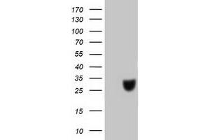 Western Blotting (WB) image for anti-Chromosome 20 Open Reading Frame 43 (C20orf43) antibody (ABIN1497038) (C20orf43 anticorps)