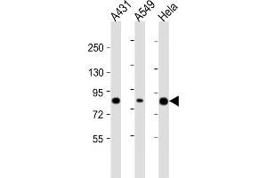 All lanes : Anti-PLA2G4D Antibody (C-Term) at 1:2000 dilution Lane 1: A431 whole cell lysate Lane 2: A549 whole cell lysate Lane 3: Hela whole cell lysate Lysates/proteins at 20 μg per lane.