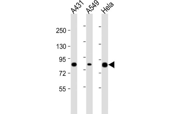 PLA2G4D anticorps  (AA 754-786)