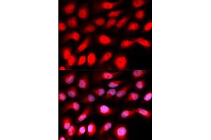 Immunofluorescence analysis of U2OS cells using ZEB1 antibody (ABIN5973261). (ZEB1 anticorps)
