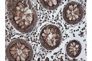 Image no. 2 for anti-Phosphoinositide-3-Kinase, Catalytic, gamma Polypeptide (PIK3CG) antibody (ABIN1500207)