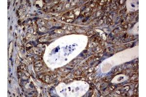 Image no. 3 for anti-3-Oxoacyl-ACP Synthase, Mitochondrial (OXSM) (AA 78-343) antibody (ABIN1491676) (OXSM anticorps  (AA 78-343))