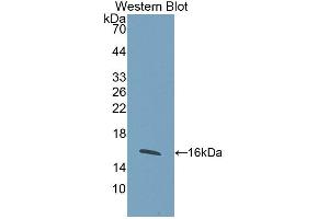 Western blot analysis of the recombinant protein. (WISP1 anticorps  (AA 216-347))