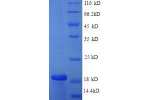 SDS-PAGE (SDS) image for Caspase 3 (CASP3) (AA 29-175), (partial) protein (His tag) (ABIN5712415)