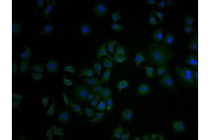 Immunofluorescence staining of A549 cells with ABIN7148235 at 1:100, counter-stained with DAPI. (COL18A1 anticorps  (AA 1600-1754))