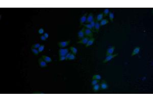 Detection of FAS in Human MCF7 cell using Polyclonal Antibody to Factor Related Apoptosis (FAS) (FAS anticorps  (AA 22-169))