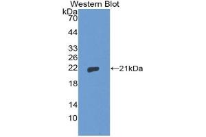 Detection of Recombinant THOP1, Human using Polyclonal Antibody to Thimet Oligopeptidase 1 (THOP1)