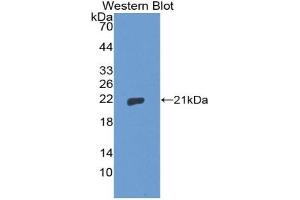 Detection of Recombinant THOP1, Human using Polyclonal Antibody to Thimet Oligopeptidase 1 (THOP1) (Thimet Oligopeptidase 1 anticorps  (AA 451-597))