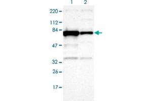 Western blot analysis of Lane 1: Human cell line RT-4 Lane 2: Human cell line U-251MG sp with OPTN polyclonal antibody  at 1:100-1:250 dilution. (OPTN anticorps)