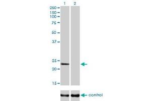 Western blot analysis of RAB9A over-expressed 293 cell line, cotransfected with RAB9A Validated Chimera RNAi (Lane 2) or non-transfected control (Lane 1). (RAB9A anticorps  (AA 17-115))