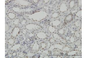 Immunoperoxidase of monoclonal antibody to CDKL1 on formalin-fixed paraffin-embedded human kidney. (CDKL1 anticorps  (AA 259-358))