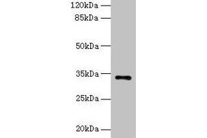 Western blot All lanes: NAT2 antibody at 6 μg/mL + Mouse brain tissue Secondary Goat polyclonal to rabbit IgG at 1/10000 dilution Predicted band size: 34 kDa Observed band size: 34 kDa (NAT2 anticorps  (AA 1-290))