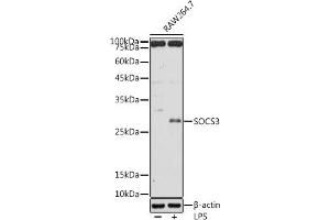 Western blot analysis of extracts of R. (SOCS3 anticorps  (C-Term))