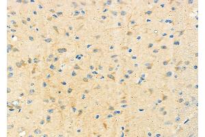 ABIN6265743 and ABIN6273181 at 1/100 staining Mouse brain tissue by IHC-P. (TRIM9 anticorps  (N-Term))