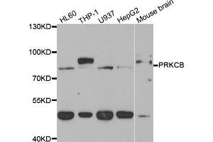 Western blot analysis of extracts of various cell lines, using PRKCB antibody (ABIN5973456) at 1/1000 dilution. (PKC beta anticorps)