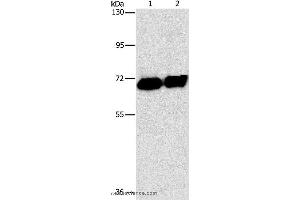 Western blot analysis of HepG2 cell and human placenta tissue, using ALPP Polyclonal Antibody at dilution of 1:1550 (PLAP anticorps)