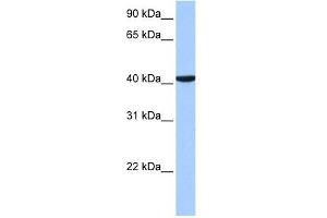 CC2D1B antibody used at 1 ug/ml to detect target protein. (CC2D1B anticorps  (C-Term))