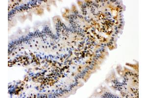 Anti- HSPA2 Picoband antibody,IHC(P) IHC(P): Mouse Intestine Tissue