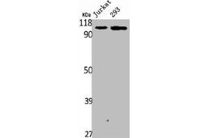 Western Blot analysis of Jurakt 293 cells using Plakophilin 2 Polyclonal Antibody (Plakophilin 2 anticorps  (C-Term))