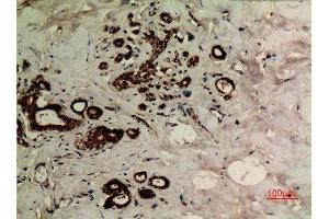Immunohistochemistry (IHC) analysis of paraffin-embedded Human Breast, antibody was diluted at 1:100.