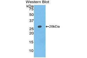 Detection of Recombinant AXIN, Rat using Polyclonal Antibody to Axis Inhibition Protein (AXIN) (Axin anticorps  (AA 618-827))