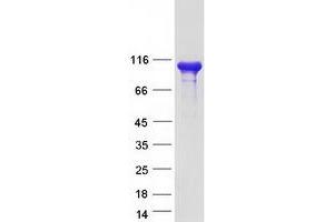 Validation with Western Blot
