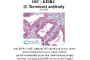 Image no. 2 for anti-Axin 2 (AXIN2) antibody (ABIN1732157) (AXIN2 anticorps)