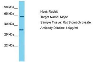 Image no. 1 for anti-Membrane Protein, Palmitoylated 2 (MAGUK P55 Subfamily Member 2) (MPP2) (C-Term) antibody (ABIN6750363) (MPP2 anticorps  (C-Term))