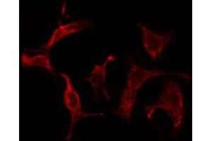 ABIN6275570 staining Hela cells by IF/ICC. (SHC2 anticorps  (Internal Region))