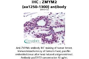 Image no. 1 for anti-Zinc Finger, MYM-Type 2 (ZMYM2) (AA 1250-1300) antibody (ABIN1740931) (ZMYM2 anticorps  (AA 1250-1300))