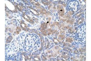 SILV antibody was used for immunohistochemistry at a concentration of 4-8 ug/ml. (Melanoma gp100 anticorps)