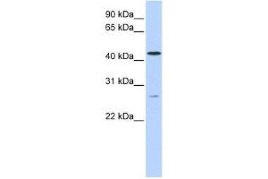 ACBD5 antibody used at 1 ug/ml to detect target protein.