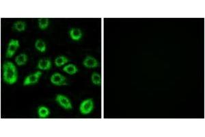 Immunofluorescence analysis of A549 cells, using ATP5D Antibody. (ATP5F1D anticorps  (AA 61-110))