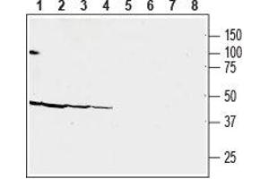 Western blot analysis of human MOLT-4 acute lymphoblastic leukemia (lanes 1 and 5), human CAKI-1 renal cell carcinoma (lanes 2 and 6), human MEG-O1 megakaryoblastic leukemia (lanes 3 and 7) and human COLO-205 colon adenocarcinoma (lanes 4 and 8) cell line lysates: - 1-4.