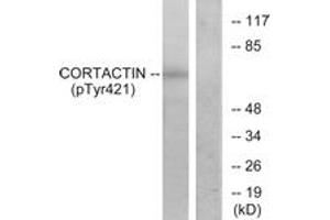 Western blot analysis of extracts from HeLa cells treated with H2O2, using Cortactin (Phospho-Tyr421) Antibody. (Cortactin anticorps  (pTyr421))