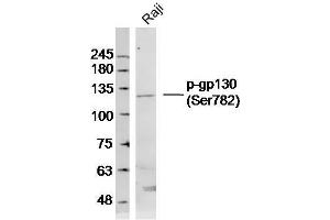 Human Raji lysates probed with phospho-CD130/gp130 (Ser782) Polyclonal Antibody, Unconjugated  at 1:300 dilution and 4˚C overnight incubation.