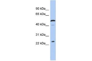 WB Suggested Anti-C1orf190 Antibody Titration: 0. (Chromosome 1 Open Reading Frame 190 (C1orf190) (Middle Region) anticorps)