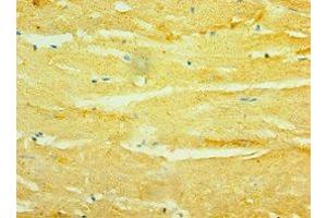 Immunohistochemistry of paraffin-embedded human heart tissue using ABIN7154912 at dilution of 1:100