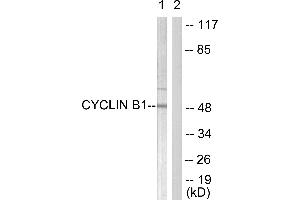 Western blot analysis of extracts from HeLa cells, treated with serum (10%, 15min), using Cyclin B1 (Ab-126) antibody (#BOO68, Line 1 and 2). (Cyclin B1 anticorps  (Ser126))